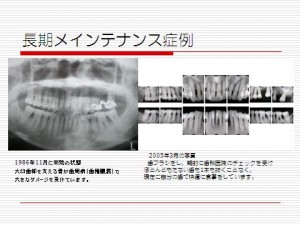 長期メインテナンス症例