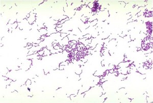 顕微鏡で見たストレプトコッカスミュータンス