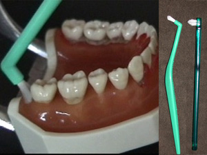 小歯ブラシによる歯磨き