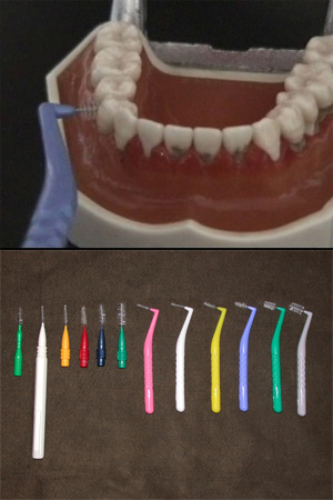 歯間ブラシによる歯磨き