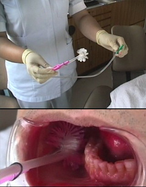 クルリーナ歯ブラシによる歯磨き
